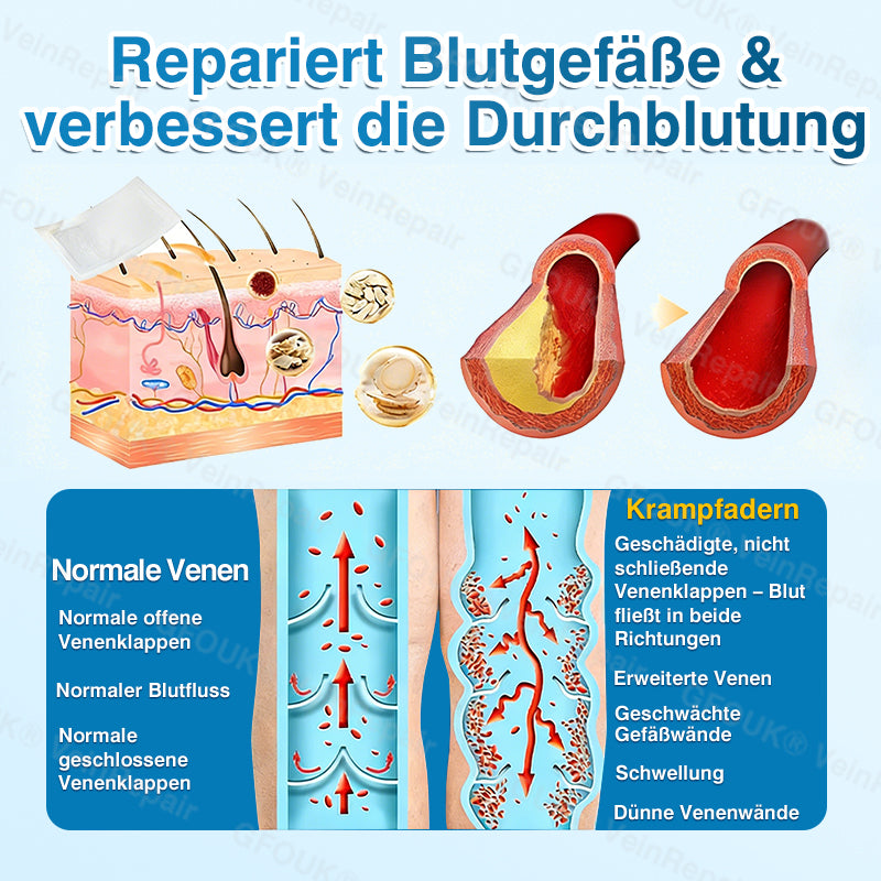 🇩🇪✅️👨⚕️✅️GFOUK® VeinRepair Mikronadel-Pflasterrolle⚡Sofortige Linderung, langfristige Ergebnisse