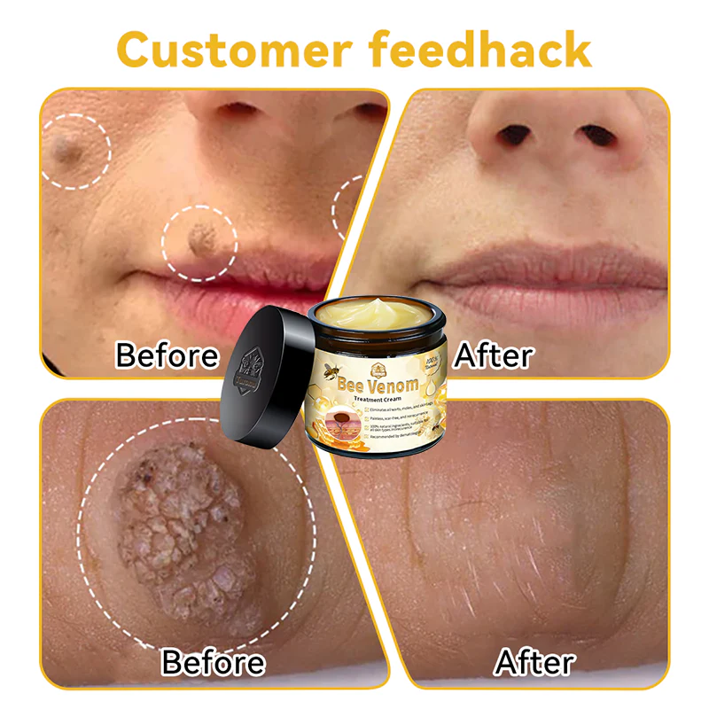 šā
TGA-REGISTERED | Turonu⢠Aussie Bee Venom Skin Treatment Cream