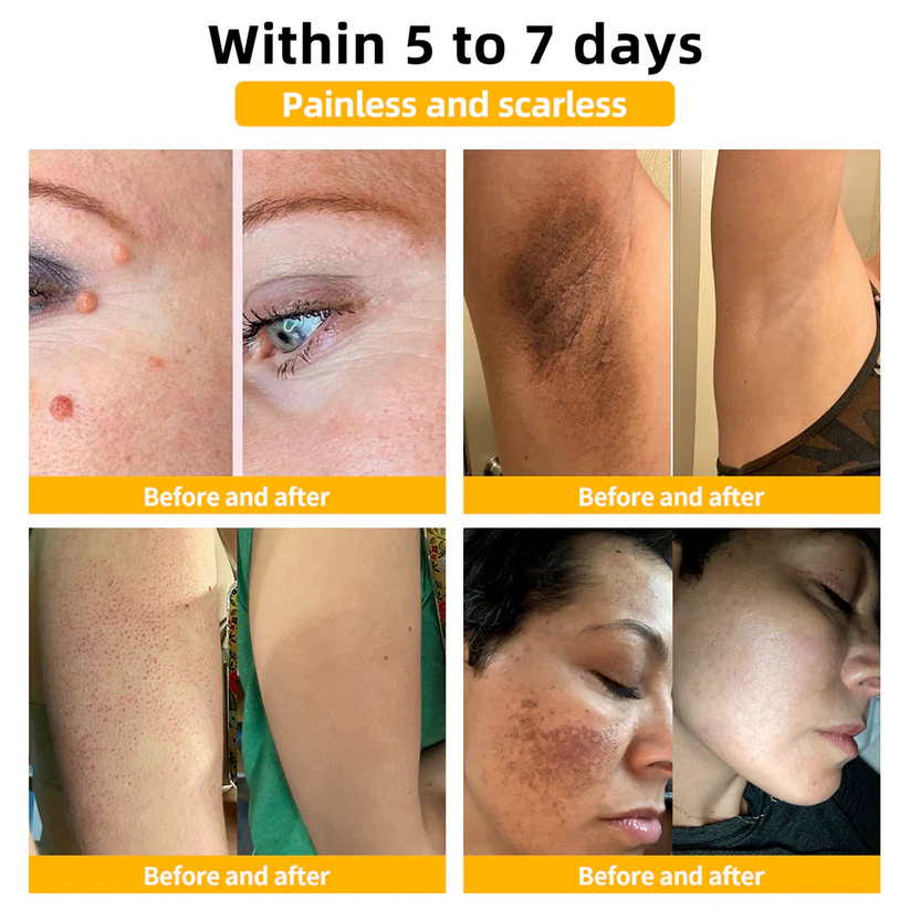 šā
TGA-REGISTERED | Turonu⢠Aussie Bee Venom Skin Treatment Cream