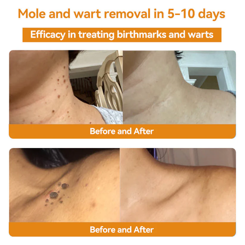 šā
TGA-REGISTERED | Turonu⢠Aussie Bee Venom Skin Treatment Cream