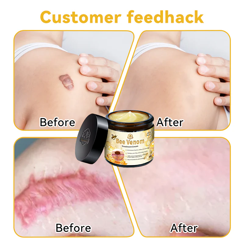 šā
TGA-REGISTERED | Turonu⢠Aussie Bee Venom Skin Treatment Cream