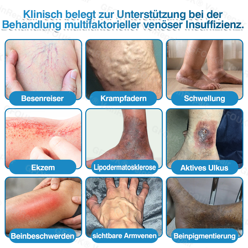 🇩🇪✅️👨‍⚕️✅️GFOUK® VeinRepair Mikronadel-Pflasterrolle⚡Sofortige Linderung, langfristige Ergebnisse