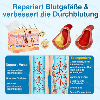 🇩🇪✅️👨‍⚕️✅️GFOUK® VeinRepair Mikronadel-Pflasterrolle⚡Sofortige Linderung, langfristige Ergebnisse
