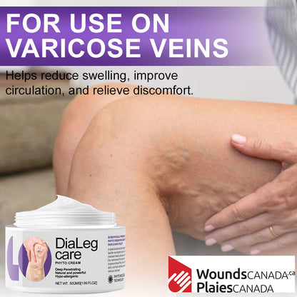 [🦵🏼Visible Results in Just 3 Days] Approved by Health Canada🍁Ourlyard® DiaLeg Care Phyto Cream – helps treat varicose veins, swelling, cramps, and leg pain
