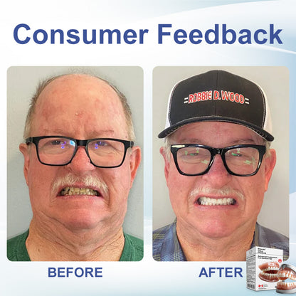 🦷𝗕𝗶𝗸𝗲𝗻𝗱𝗮® 𝗔𝗱𝘃𝗮𝗻𝗰𝗲𝗱 𝗖𝘂𝘀𝘁𝗼𝗺𝗶𝘇𝗲𝗱 𝗙𝘂𝗹𝗹 𝗗𝗲𝗻𝘁𝘂𝗿𝗲 𝗦𝗲𝘁 🦷 （Clinically backed comfort-fit dentures — trusted by 8,000+ Canadians. ⏰Limited-time offer ends in 30 minutes.）