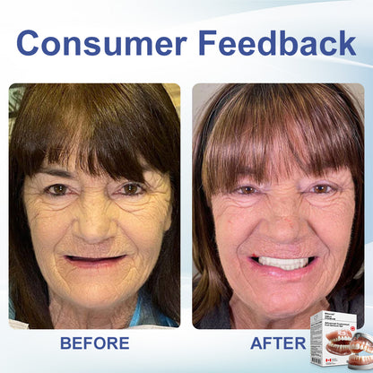 🦷𝗕𝗶𝗸𝗲𝗻𝗱𝗮® 𝗔𝗱𝘃𝗮𝗻𝗰𝗲𝗱 𝗖𝘂𝘀𝘁𝗼𝗺𝗶𝘇𝗲𝗱 𝗙𝘂𝗹𝗹 𝗗𝗲𝗻𝘁𝘂𝗿𝗲 𝗦𝗲𝘁 🦷 （Clinically backed comfort-fit dentures — trusted by 8,000+ Canadians. ⏰Limited-time offer ends in 30 minutes.）