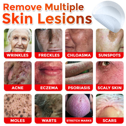🔥GFOUK® MicroNeedle Botanic Skin Tag Removal Patch 🇺🇸 Made in the USA