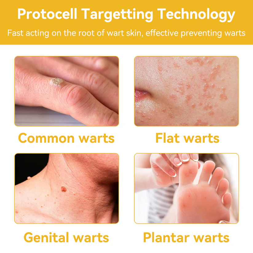 🌍✅TGA-REGISTERED | Turonu™ Aussie Bee Venom Skin Treatment Cream