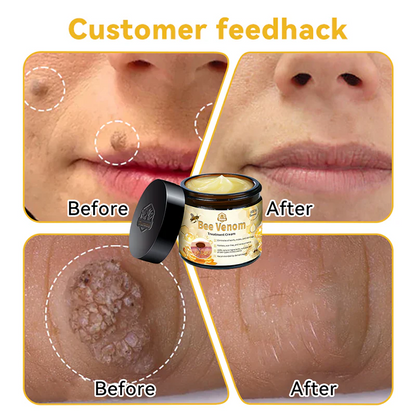 🌍✅TGA-REGISTERED | Turonu™ Aussie Bee Venom Skin Treatment Cream